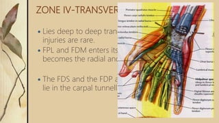 ZONE IV-TRANSVERSE CARPAL LIGAMENT
 Lies deep to deep transverse ligament. Tendon
injuries are rare.
 FPL and FDM enters its continuous sheath which
becomes the radial and ulnar bursae.
 The FDS and the FDP also enter a large sheath and
lie in the carpal tunnell
 