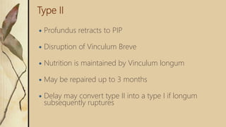 Type II
 Profundus retracts to PIP
 Disruption of Vinculum Breve
 Nutrition is maintained by Vinculum longum
 May be repaired up to 3 months
 Delay may convert type II into a type I if longum
subsequently ruptures
 
