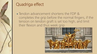 Quadriga effect
 Tendon advancement shortens the FDP &
completes the grip before the normal fingers, if the
tension on tendon graft is set too high, and limit
their flexion and thus week grip
 