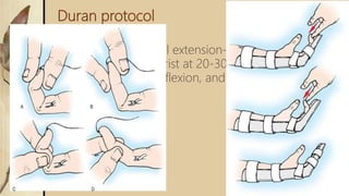Duran protocol
 At surgery, a dorsal extension-block splint is
applied with the wrist at 20-30° of flexion, the MCP
joints at 50-60° of flexion, and the IP joints straight
 