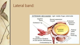 Lateral band:
 