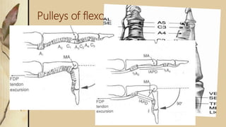 Pulleys of flexour
 Synovial sheath is reinforced by a system of fibrous pulleys
 5 annular pulleys (A) and
 3 Cruciform pulleys (C)
 A1: 8-10 mm over MCPJ
 A2: 18-20mm over proximal phalanx
 A3: 2-4 mm over PIPJ
 A4: 10-12mm over middle phalanx
 A5: 2-4 mm over DIPJ
 C1, C2, C3 proximal to A3, A4, A5
 Allow shortening of the pulley system in flexion
 A2 and A4 are considered most important. Their disruption
 leads to bowstringing, reduced mechanical efficiency and decreased flexion.
 Function: increase the mechanical efficiency by preventing bowstringing
 