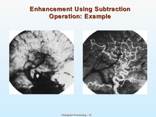 Histogram Processing : 15
Enhancement Using SubtractionEnhancement Using Subtraction
Operation: ExampleOperation: Example
 