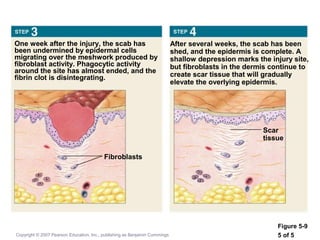 Integumentary | PPT