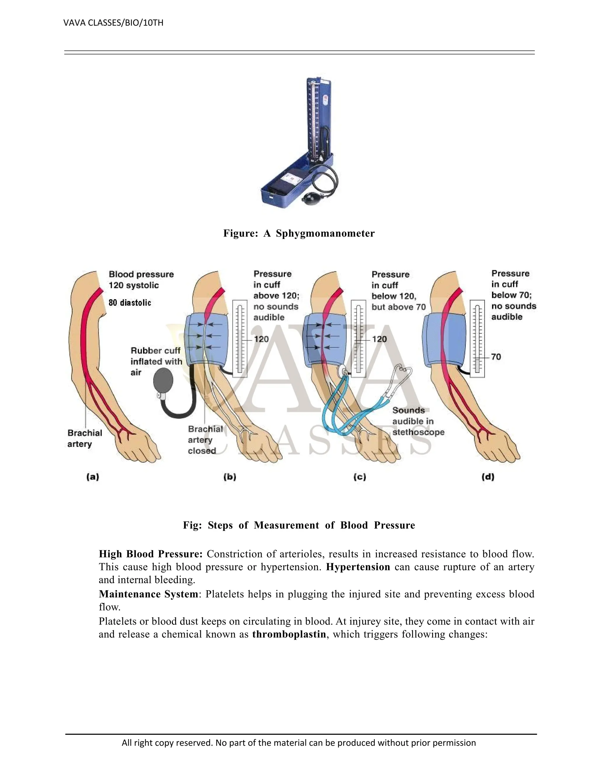 Figure: A Sphygmomanometer
Fig: Steps of Measurement of Blood Pressure
High Blood Pressure: Constriction of arterioles, results in increased resistance to blood flow.
This cause high blood pressure or hypertension. Hypertension can cause rupture of an artery
and internal bleeding.
Maintenance System: Platelets helps in plugging the injured site and preventing excess blood
flow.
Platelets or blood dust keeps on circulating in blood. At injurey site, they come in contact with air
and release a chemical known as thromboplastin, which triggers following changes:
VAVA CLASSES/BIO/10TH
All right copy reserved. No part of the material can be produced without prior permission
 