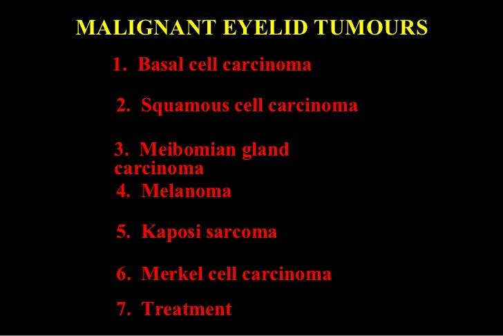Basal Cell Carcinoma Eyelid Slideshare
