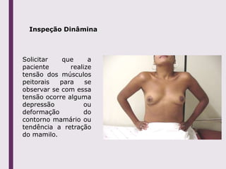 Inspeção Dinâmina
Solicitar que a
paciente realize
tensão dos músculos
peitorais para se
observar se com essa
tensão ocorre alguma
depressão ou
deformação do
contorno mamário ou
tendência a retração
do mamilo.
 
