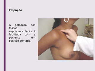 Palpação
A palpação das
fossas
supraclaviculares é
facilitada com a
paciente em
posição sentada.
 