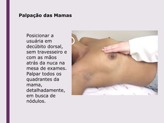 Palpação das Mamas
Posicionar a
usuária em
decúbito dorsal,
sem travesseiro e
com as mãos
atrás da nuca na
mesa de exames.
Palpar todos os
quadrantes da
mama,
detalhadamente,
em busca de
nódulos.
 