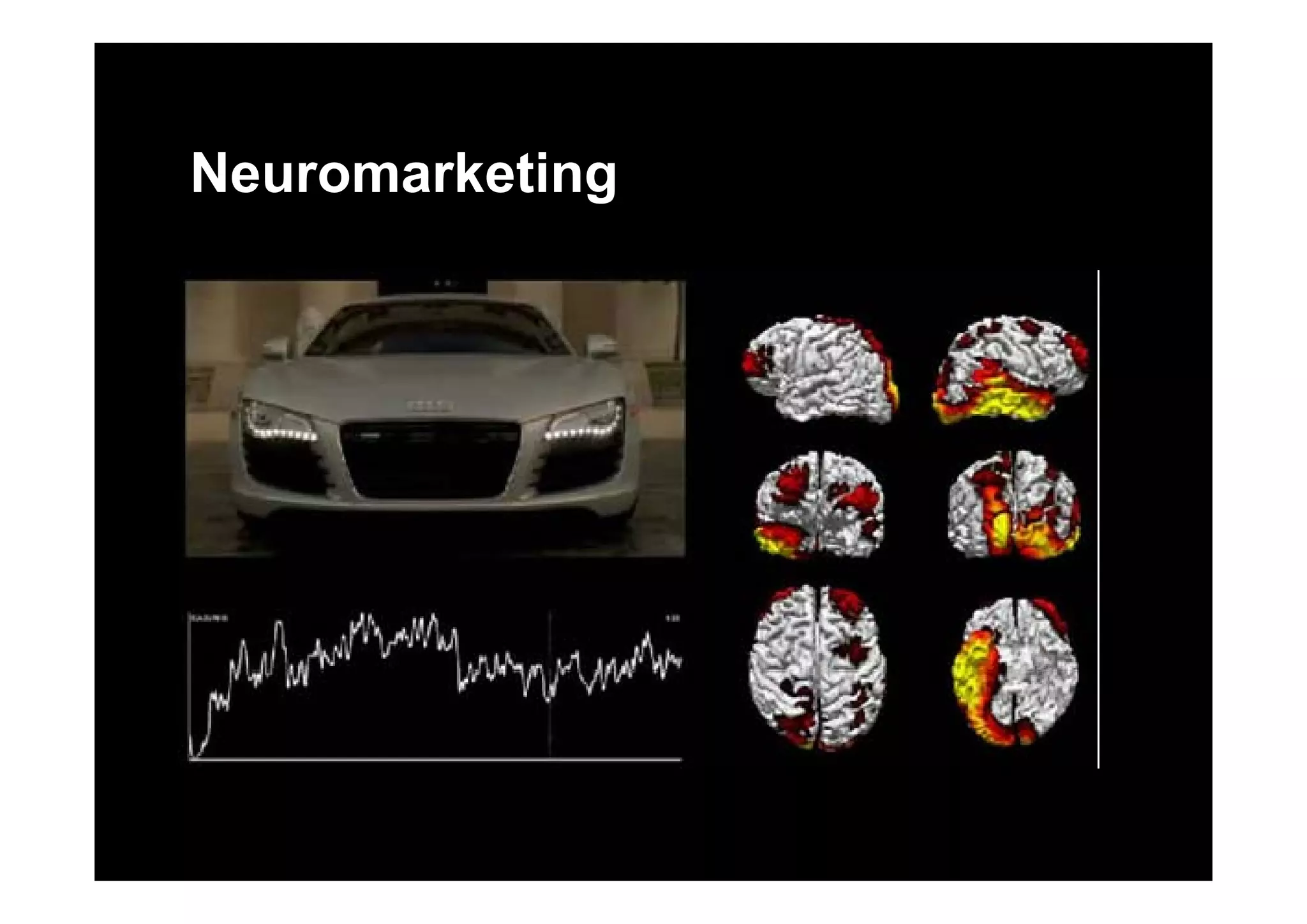 Neuromarketing
 