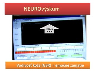 ó
                +++




Vodivosť kože (GSR) = emočné zaujatie
 
