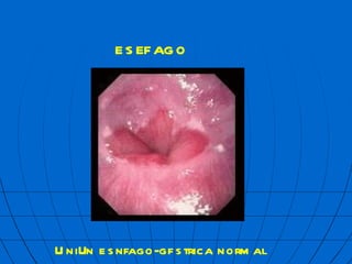 Uni  n es  fago-g  strica normal ES  FAGO 