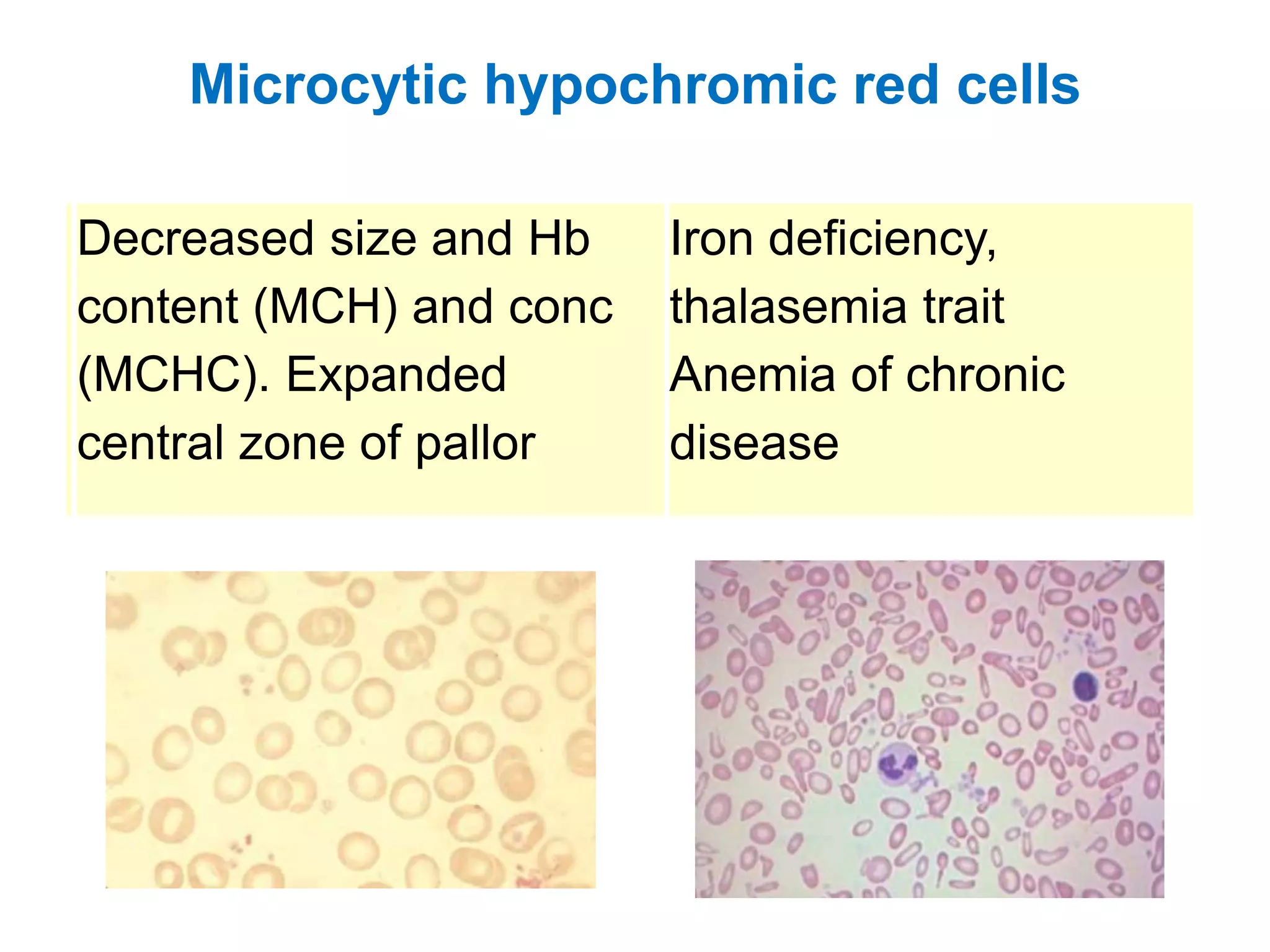 05 peripheral blood smear examination | PPTX