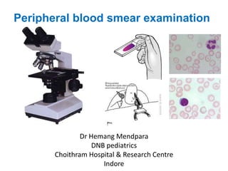 Peripheral blood smear examination
Dr Hemang Mendpara
DNB pediatrics
Choithram Hospital & Research Centre
Indore
 