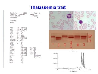 Thalassemia trait
 