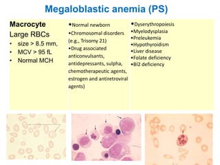Megaloblastic anemia (PS)
Macrocyte
Large RBCs
• size > 8.5 mm,
• MCV > 95 fL
• Normal MCH
•Normal newborn
•Chromosomal disorders
(e.g., Trisomy 21)
•Drug associated
anticonvulsants,
antidepressants, sulpha,
chemotherapeutic agents,
estrogen and antiretroviral
agents)
•Dyserythropoiesis
•Myelodysplasia
•Preleukemia
•Hypothyroidism
•Liver disease
•Folate deficiency
•BI2 deficiency
 