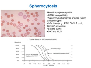 Spherocytosis
Hereditary spherocytosis
•ABO incompatibility
•Autoimmune hemolytic anemia (warm
antibody type)
•Infections (e.g., EBV, CMV, E. coli,
Sepsis/Urosepsis)
•Severe burns
•DIC and HUS
 