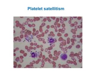 Platelet satellitism
 