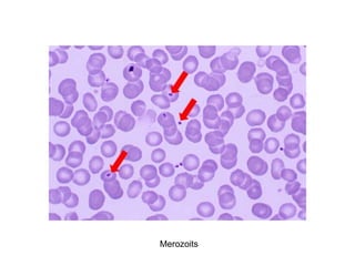 Merozoits
 