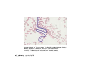 Eucheria bancrofti
 