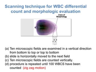 (a) Ten microscopic fields are examined in a vertical direction
from bottom to top or top to bottom
(b) slide is horizontally moved to the next field
(c) Ten microscopic fields are counted vertically.
(d) procedure is repeated until 100 WBCS have been
counted (zig zag motion)
Scanning technique for WBC differential
count and morphologic evaluation
 