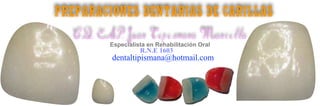 Preparaciones dentarias de Carillas
CD. ESP. Juan Tipismana Mancilla
Especialista en Rehabilitación Oral
dentaltipismana@hotmail.com
R.N.E 1603
 