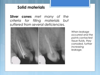 Solid materials
Silver cones met many of the
criteria for filling materials but
suffered from several deficiencies.
When leakage
occurred and the
points contacted
tissue fluids, they
corroded, further
increasing
leakage.
 