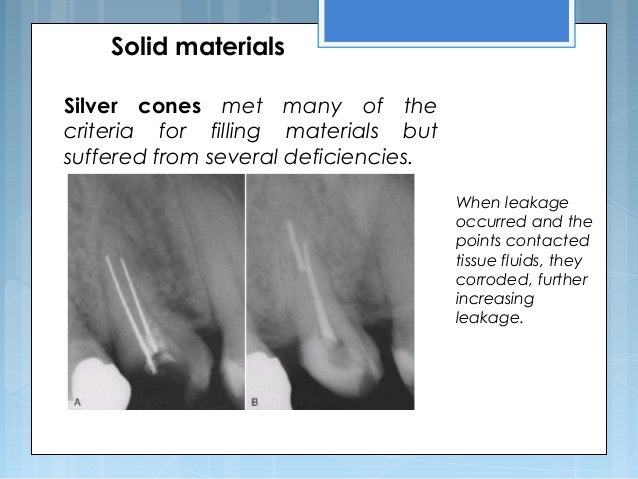 root canal filling material