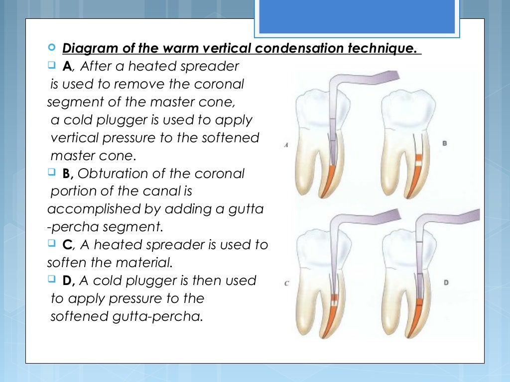 Root canal filling instruments and materials