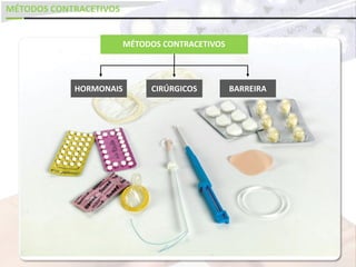 MÉTODOS CONTRACETIVOS
MÉTODOS CONTRACETIVOS
HORMONAIS CIRÚRGICOS BARREIRA
 
