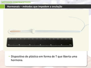 MÉTODOS CONTRACETIVOS
Hormonais – métodos que impedem a ovulação
• Dispositivo de plástico em forma de T que liberta uma
hormona.
 