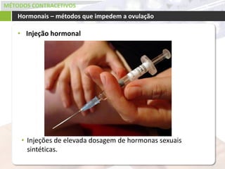 MÉTODOS CONTRACETIVOS
• Injeção hormonal
Hormonais – métodos que impedem a ovulação
• Injeções de elevada dosagem de hormonas sexuais
sintéticas.
 