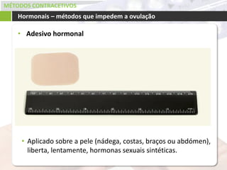 MÉTODOS CONTRACETIVOS
• Adesivo hormonal
Hormonais – métodos que impedem a ovulação
• Aplicado sobre a pele (nádega, costas, braços ou abdómen),
liberta, lentamente, hormonas sexuais sintéticas.
 