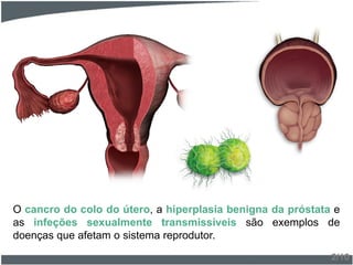 O cancro do colo do útero, a hiperplasia benigna da próstata e
as infeções sexualmente transmissíveis são exemplos de
doenças que afetam o sistema reprodutor.
2/10
 