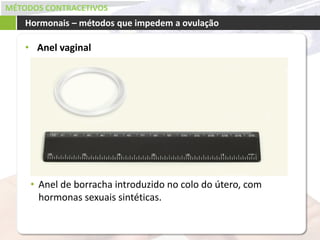 MÉTODOS CONTRACETIVOS
• Anel vaginal
Hormonais – métodos que impedem a ovulação
• Anel de borracha introduzido no colo do útero, com
hormonas sexuais sintéticas.
 