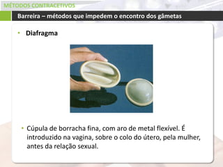 MÉTODOS CONTRACETIVOS
• Diafragma
Barreira – métodos que impedem o encontro dos gâmetas
• Cúpula de borracha fina, com aro de metal flexível. É
introduzido na vagina, sobre o colo do útero, pela mulher,
antes da relação sexual.
 