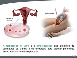 A fertilização in vitro e a amniocentese são exemplos de
contributos da ciência e da tecnologia para atenuar problemas
associados ao sistema reprodutor.
7/10
Fertilização
in vitro
Amniocentese
 