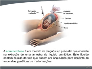 A amniocintese é um método de diagnóstico pré-natal que consiste
na extração de uma amostra de líquido amniótico. Este líquido
contém células do feto que podem ser analisadas para despiste de
anomalias genéticas ou malformações.
9/10
Aparelho
de ultrassons
Seringa de
aspiração
Placenta
Útero
Líquido amniótico
 