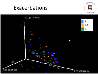 Exacerbations
0
1-2
3+
Dicker et al. Presented at ATS 2016
 