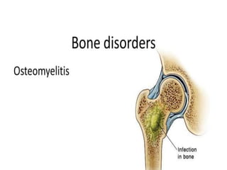 05 Skeletal Tissue.pptx scienc.e gen bio