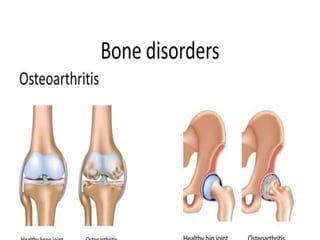 05 Skeletal Tissue.pptx scienc.e gen bio