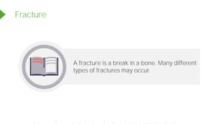 A fracture is a break in a bone. Many different
types of fractures may occur.
Fracture
Powered by TCPDF (www.tcpdf.org)
 