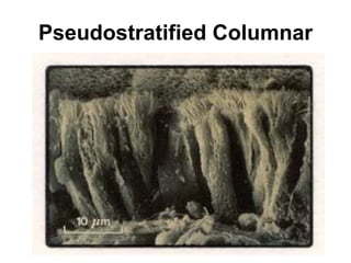 Pseudostratified Columnar 