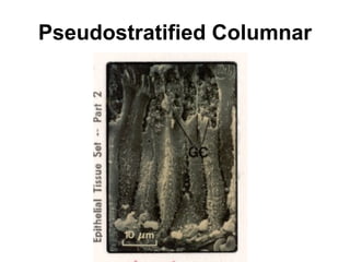 Pseudostratified Columnar 