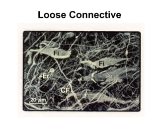Loose Connective 