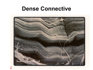 Dense Connective 