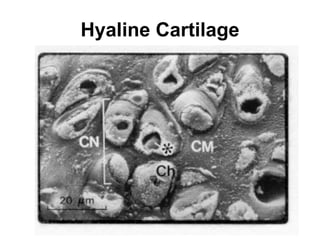 Hyaline Cartilage 