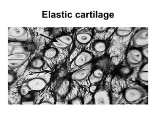 Elastic cartilage 