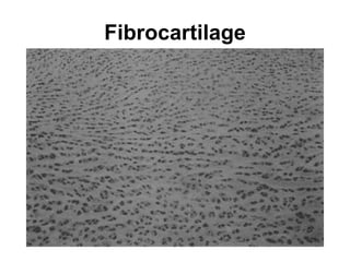 Fibrocartilage 