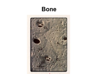 Bone 